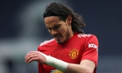 Edinson Cavani khiến MU thiệt đơn thiệt kép