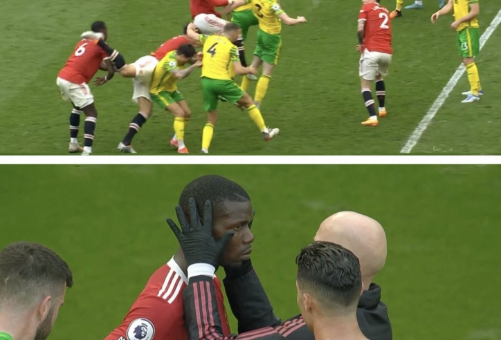 Ngày thi đấu đáng quên của Pogba: Bị Maguire đá chảy máu đầu, bị fan MU la ó và hắt hủi